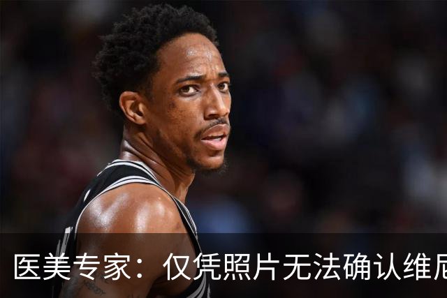 医美专家：仅凭照片无法确认维尼修斯做过哪些医美项目